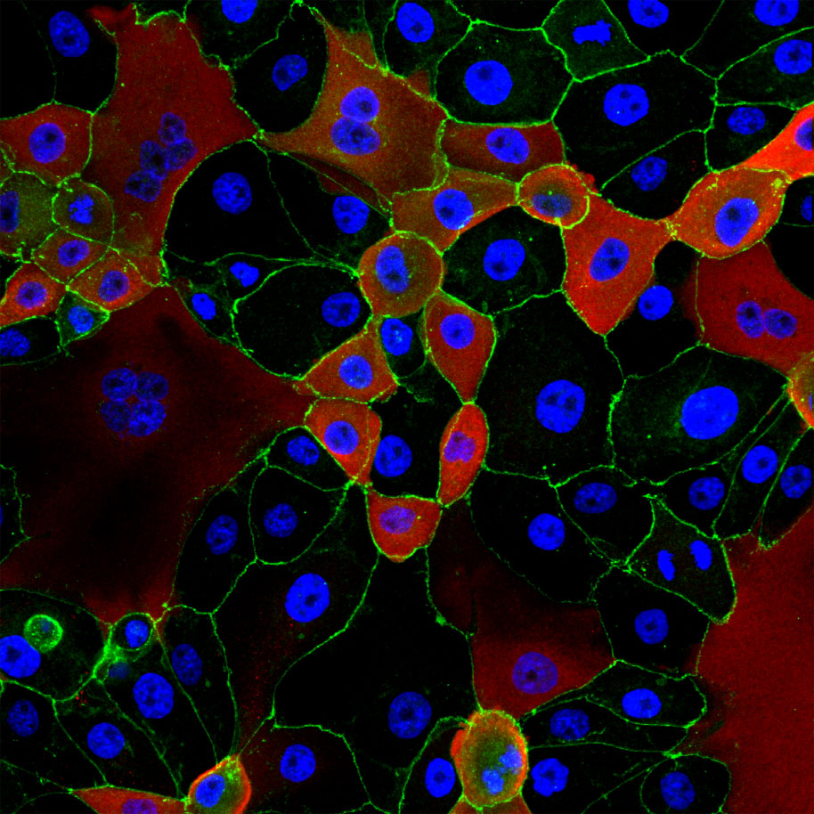 A false-color microscopic image of FCV cells