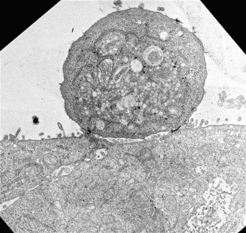 A microscopic image of an FCV-infected epithelial cell
